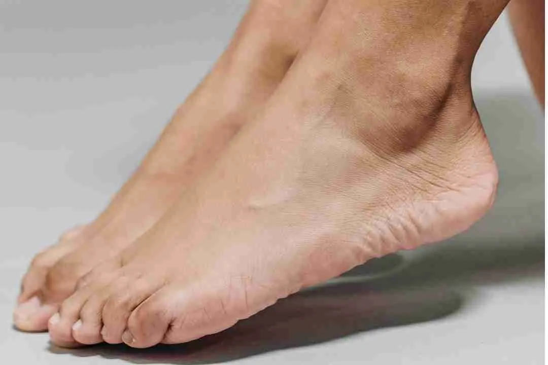 Las uñas enterradas
